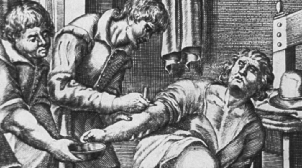 Bloodletting in the 1800s