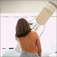Should I get a Mammogram at Age 40?